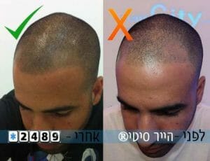 קעקועי שיער