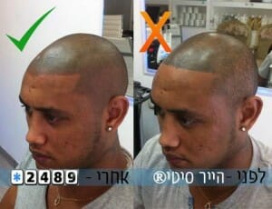 קעקוע שיער